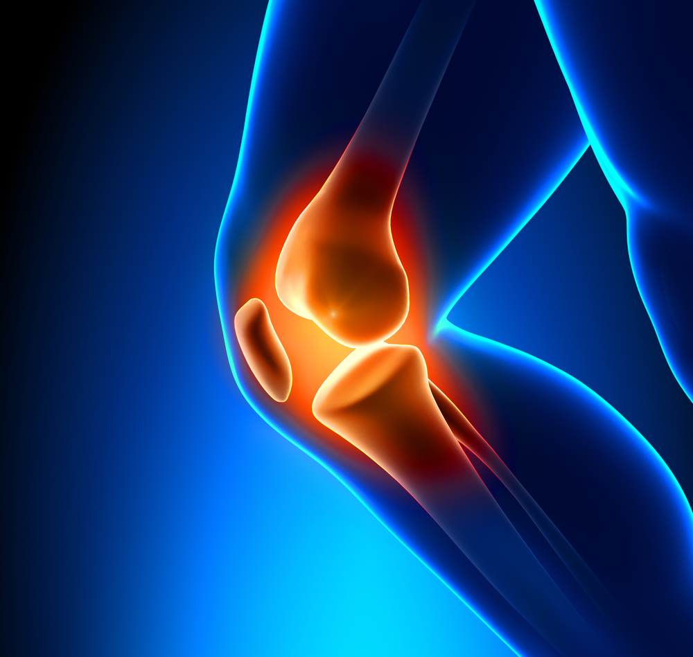 Patellofemoral Pain Syndrome - Capital Physiotherapy