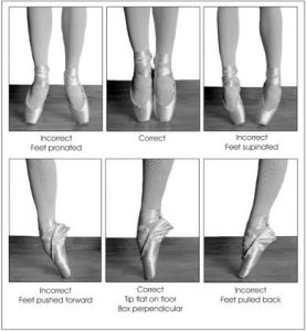 Common Dancer Foot Injuries & How Physiotherapy Can Help