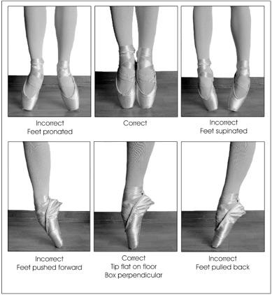 How Ballet Can Damage Your Feet – Cleveland Clinic