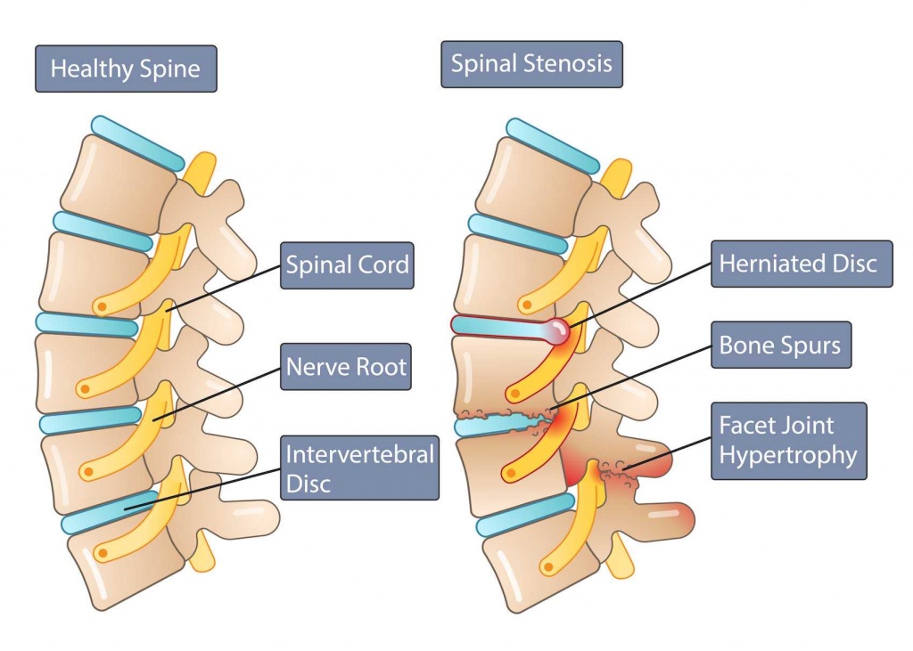 capital-physiotherapy-spine-anatomy-diagram